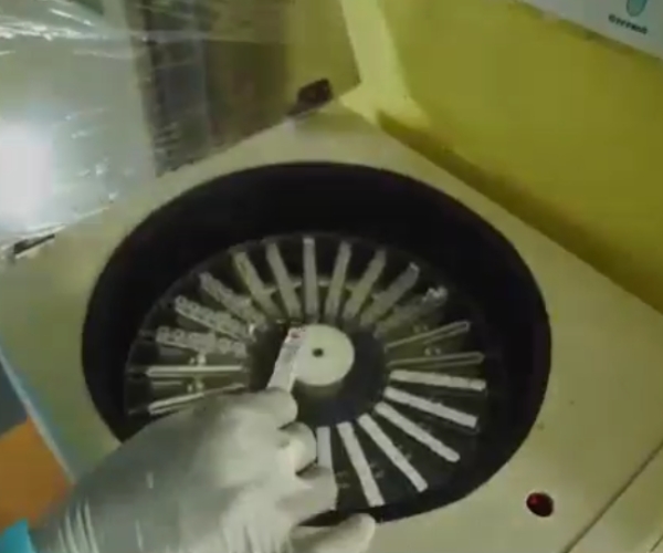 Matrix gel technology lab